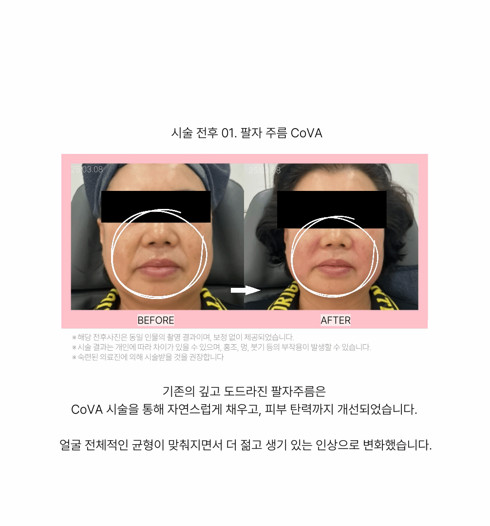 랜딩이미지