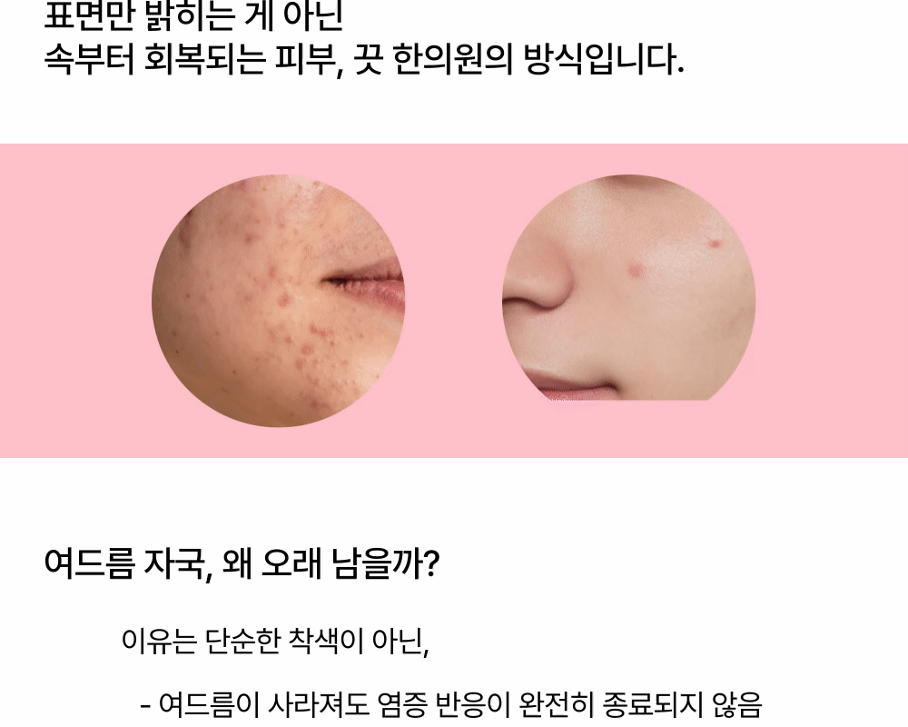 랜딩이미지